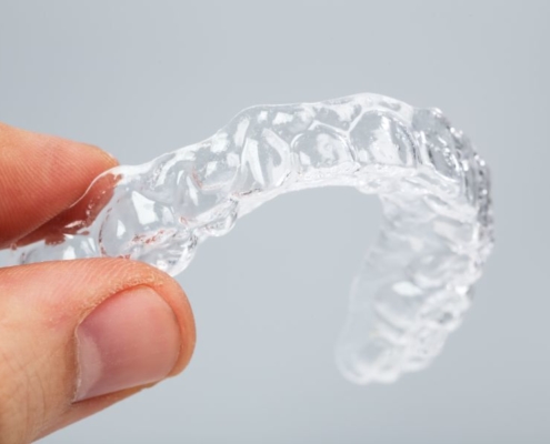 Is Invisalign Worth It?