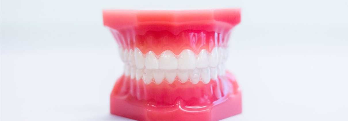 invisalign santa ana