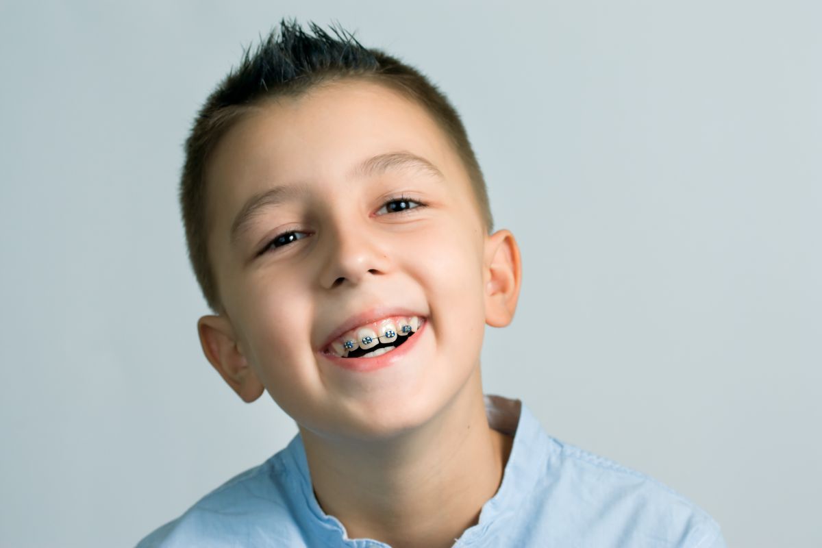 Young child smiling to show metal braces during early orthodontic treatment